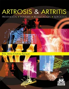 Artrosis & artritis - Aida Cristina Ejarque