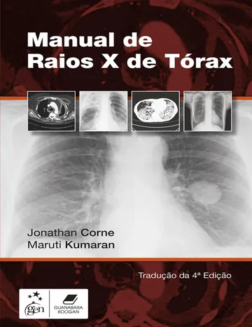 Manual de Raios X de Tórax de Jonathan Corne e Maruti Kumaran, capa do livro