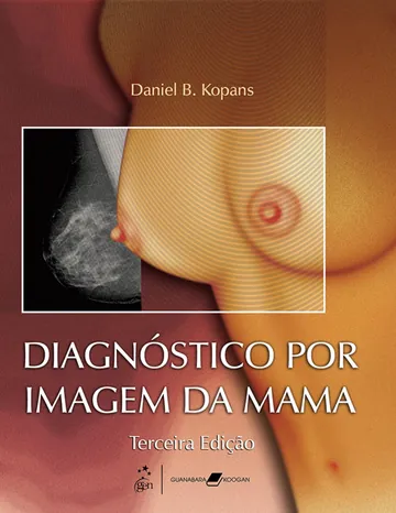 Diagnóstico por Imagem da Mama, 3ª edição de Daniel B. Kopans, capa do livro