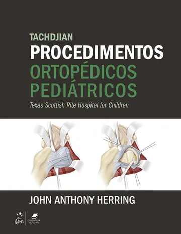 Tachdjian Procedimentos Ortopédicos Pediátricos de John A. Herring, capa do livro