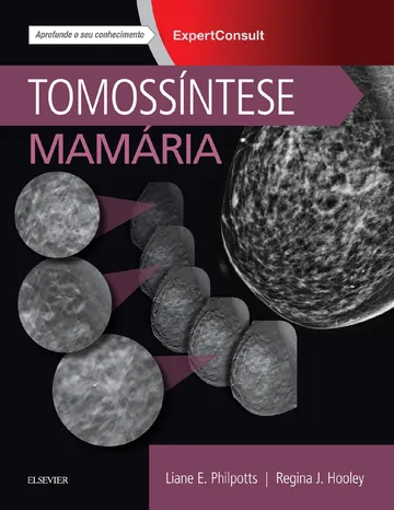 Tomossíntese Mamária de Liane E. Philpotts, capa do livro