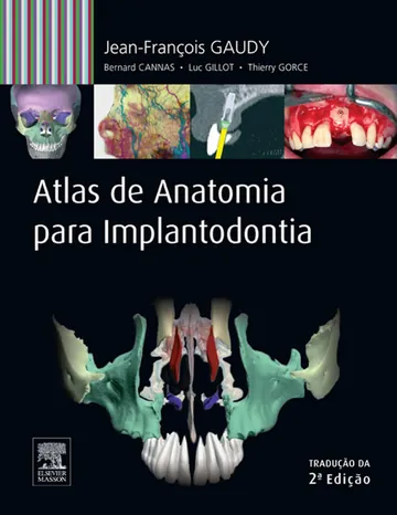 Atlas de Anatomia para Implantodontia de Jean-François Gaudy, Bernard Cannas, Luc Gillot, Thierry Gorce, capa do livro